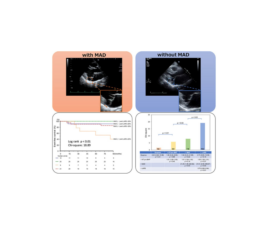 【論文掲載の報告】Barlow病における心血管イベントにおけるMitral annular disjunctionと左房リザーバーストレインの関連について　（谷　知子先生）